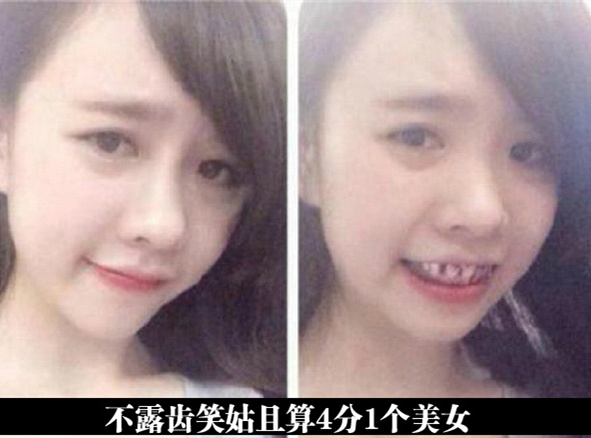 去整整牙齿吧……