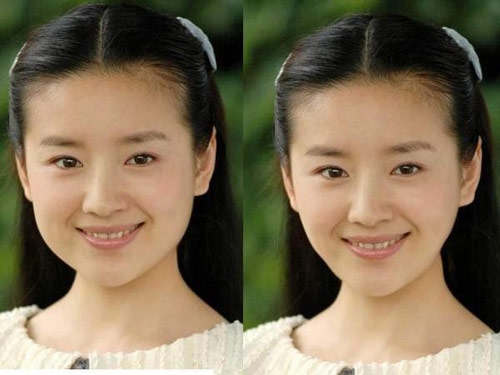 董洁变成锥子脸了，元芳，你怎么看