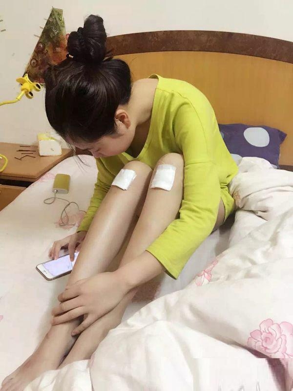 妹子老实说你膝盖怎么搞的