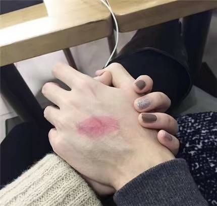 我是手控，，你们呐♡